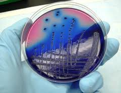 Analise Microbiológica, óleo e água